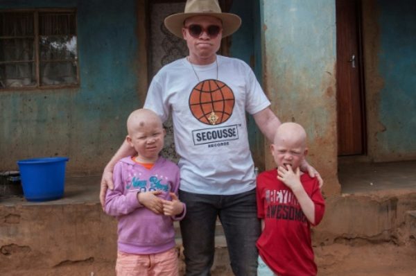 Au Malawi, un « fils » de Salif Keita au service de la cause albinos