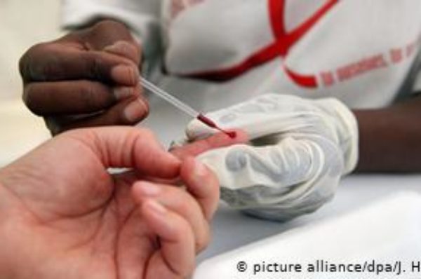 RCA: les malades du sida vulnérables face à la Covid-19