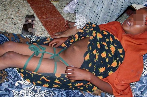 Tchad : les jeunes filles toujours livrées à l’excision